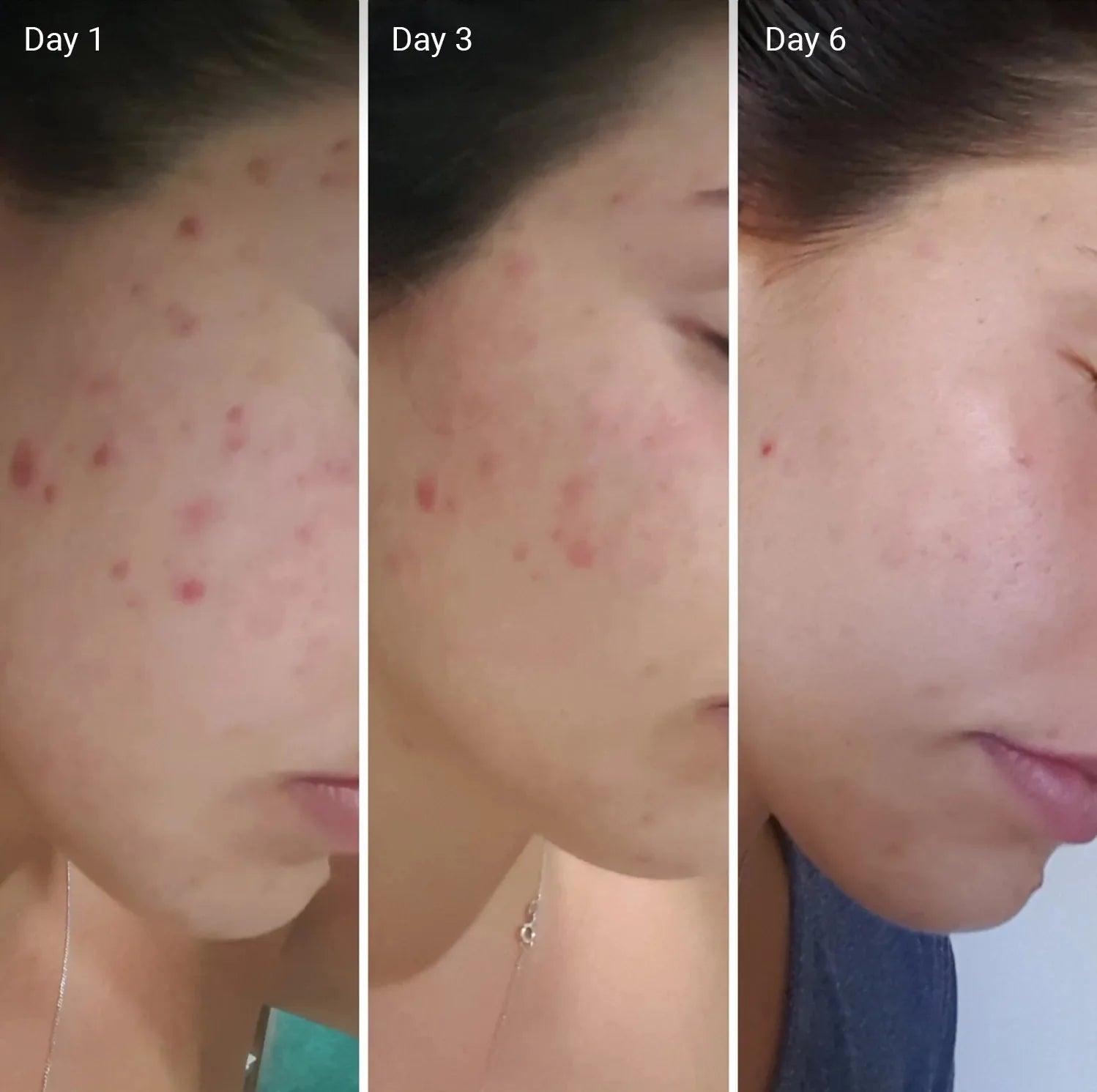 kojic acid & glutathione Zafrani Beauty Cream (Visible Result in 7 Days)